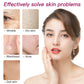 SteamTherapy Facial Machine